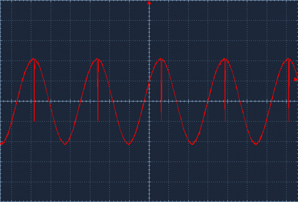 sinus.PNG